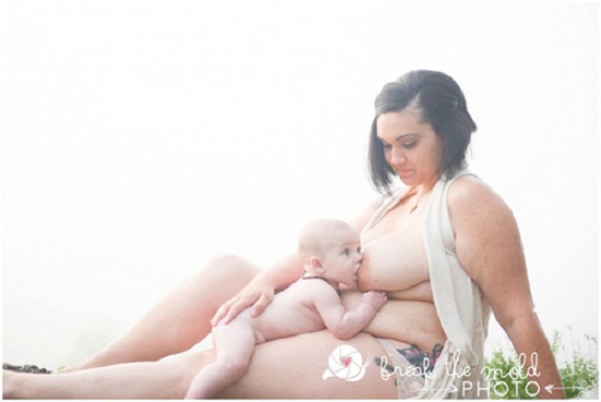 Phụ nữ đang nuôi con bằng sữa mẹ không nên hút mỡ bụng