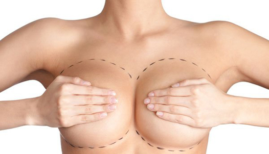 Tiêu chí xác định đơn vị nâng ngực hiệu quả và an toàn